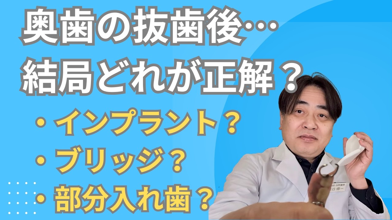 【奥歯の抜歯】放置はNG？インプラント・ブリッジ・部分入れ歯で迷った私の結論