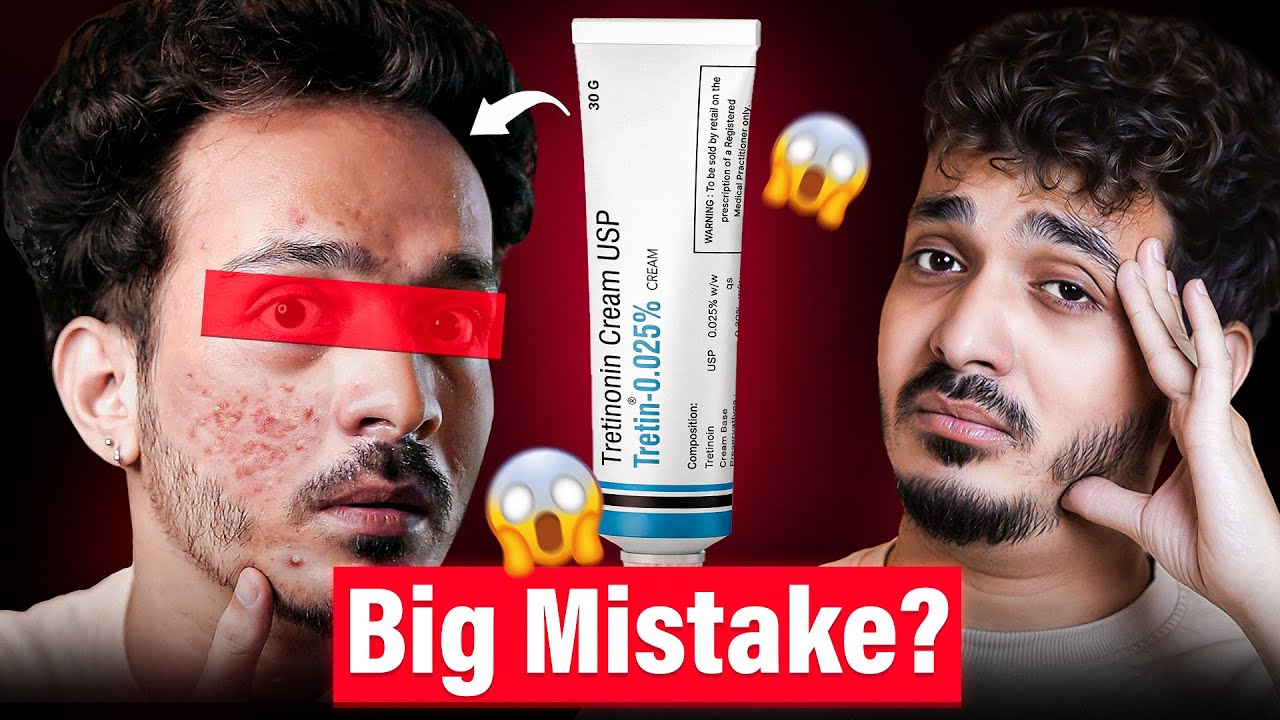 I Used Tretinoin for 4 Months… This Happened 😱