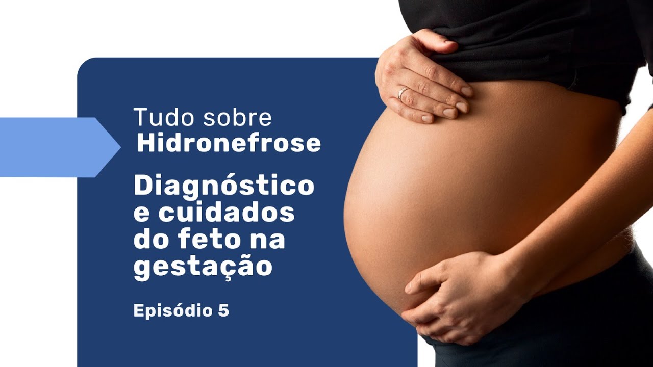 Hidronefrose no Feto: &Eacute; Poss&iacute;vel Tratar Antes do Nascimento? | Dr. Rafael Pinto