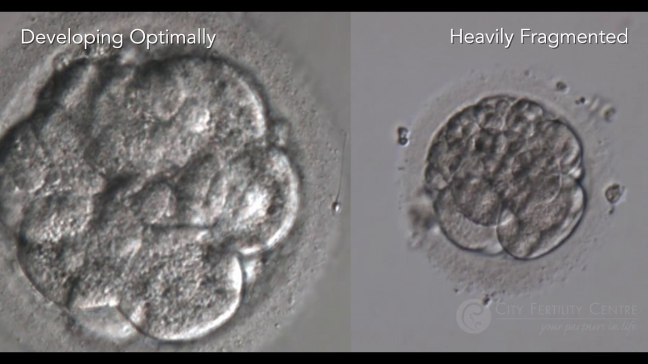Optimal Embryo Development and Assessment