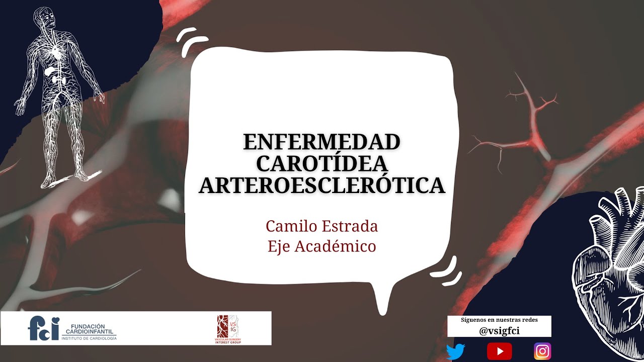 Enfermedad Carotídea Aterosclerótica