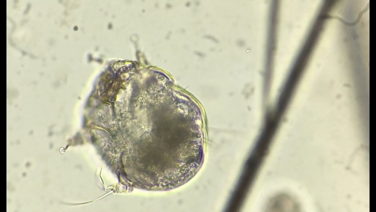 V Plzni ř&aacute;d&iacute; svrab l ZAK ZPR&Aacute;VY