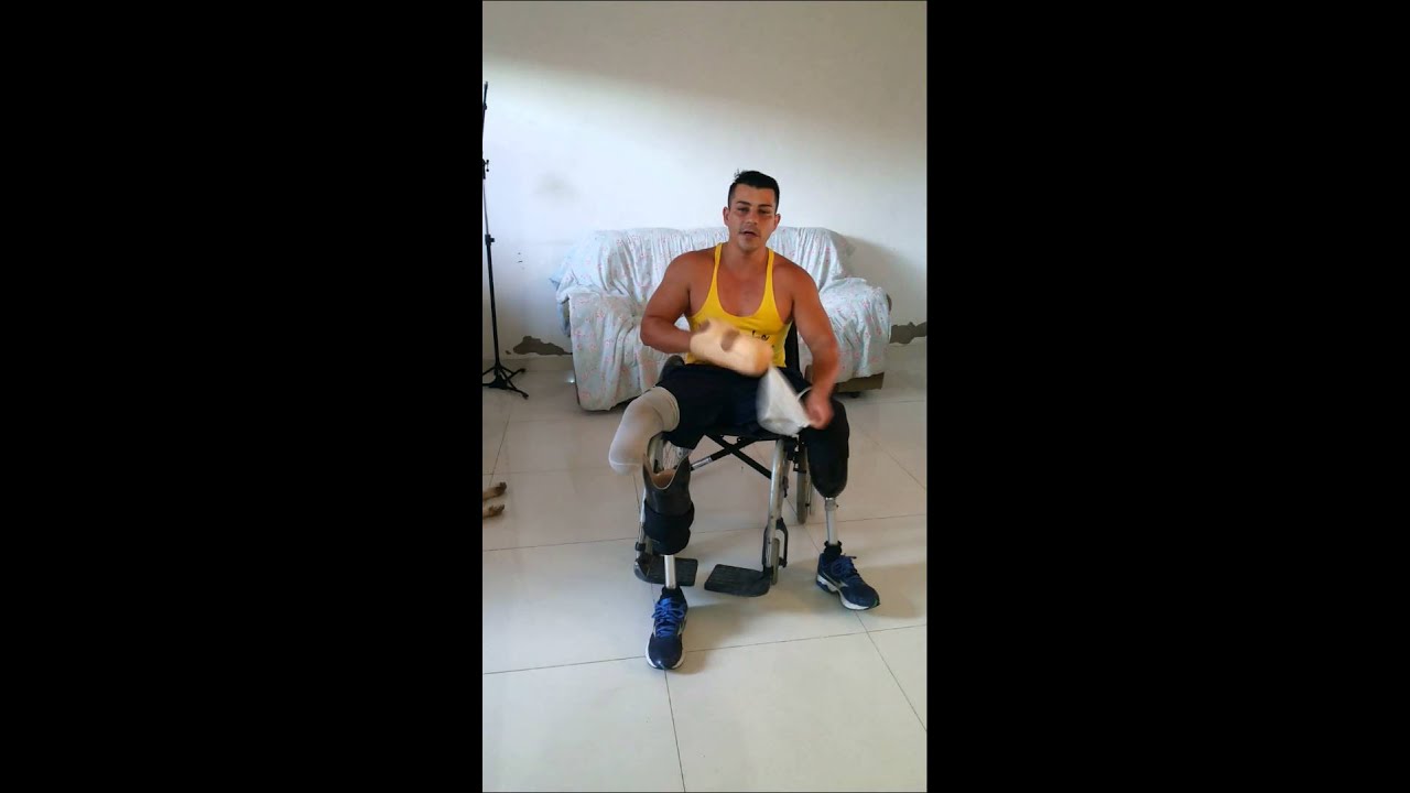 Rafael andrigo amputado