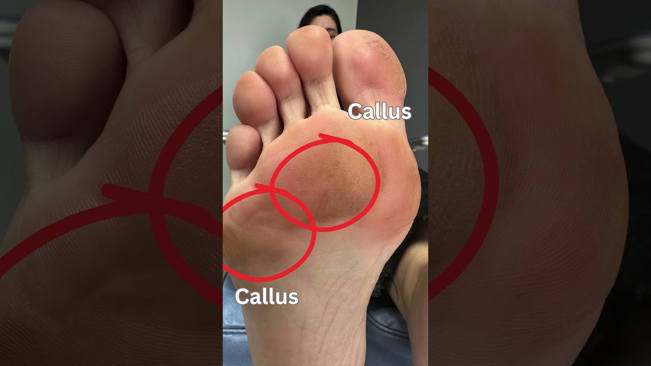 A Medical Pedicure at Concierge Podiatry & Spa is unlike any other pedicure you have had.