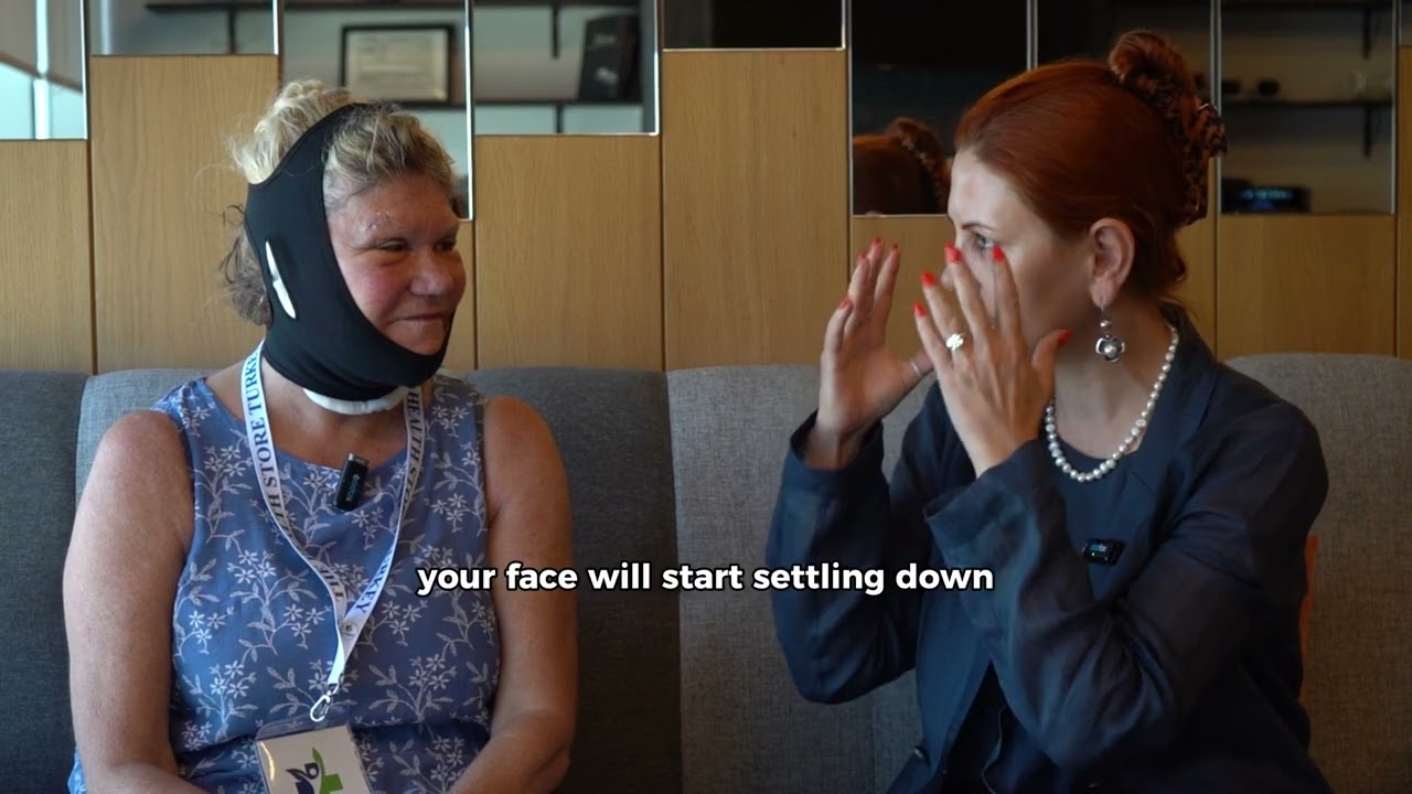 Vivian’s 7-Day Journey in Turkey | Deep Plane Facelift, Brow Lift & Blepharoplasty