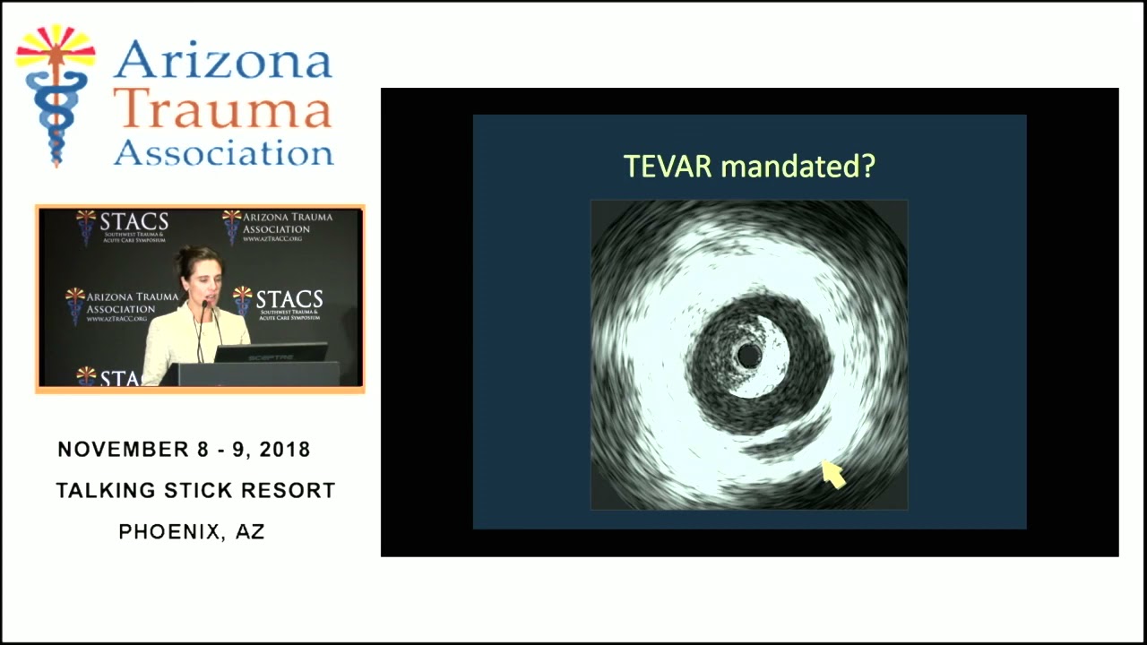 Diagnosis and Contemporary Treatment of Blunt Thoracic Aortic Injuries, Presented at STACS 2018