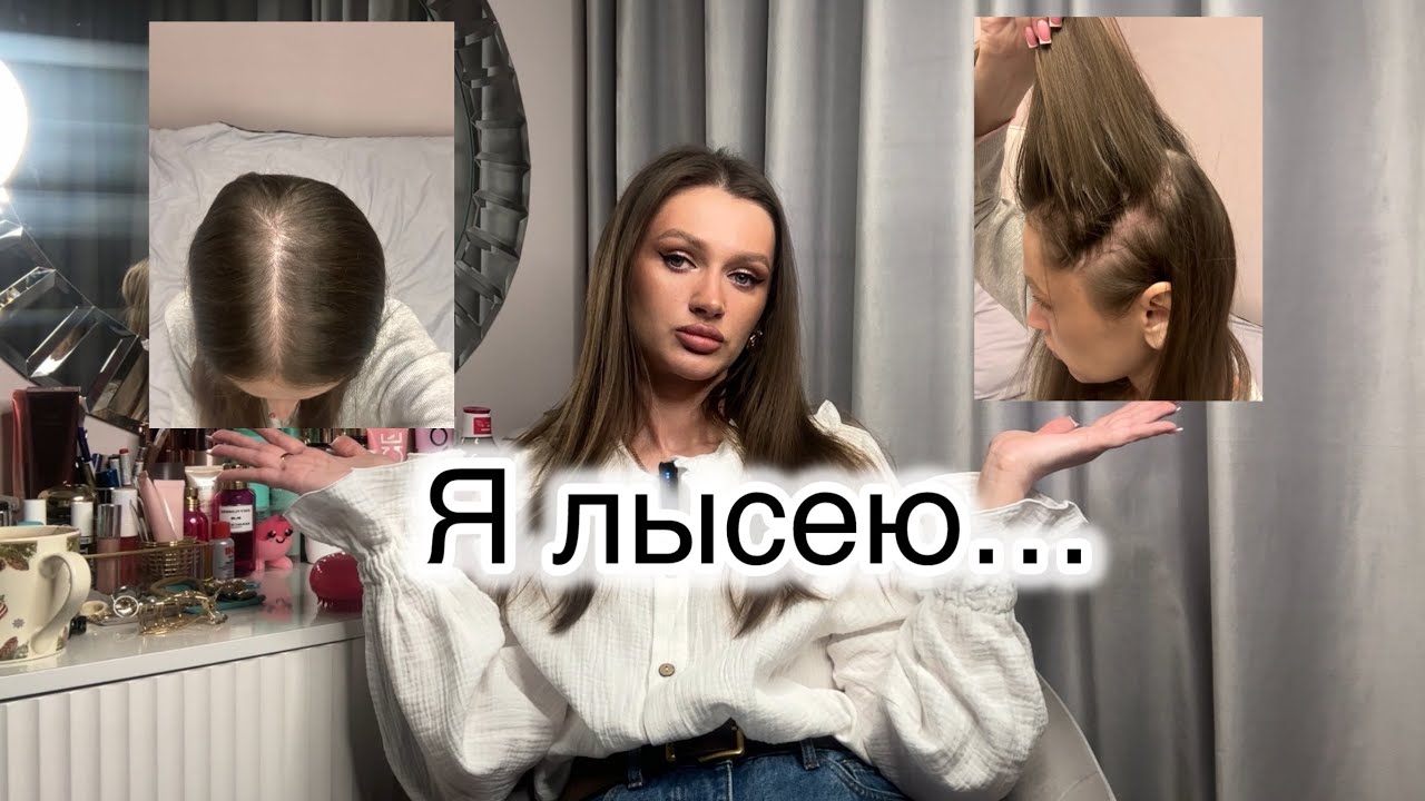 Как я узнала , что лысею !? Женская алопеция .