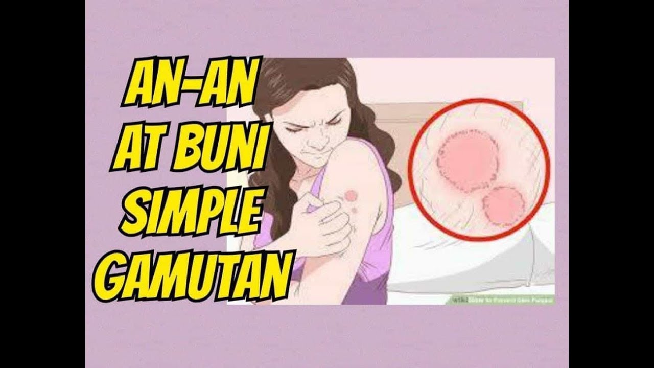 An-An at Buni: Simpleng Gamutan - ni Doc Liza Ong #276