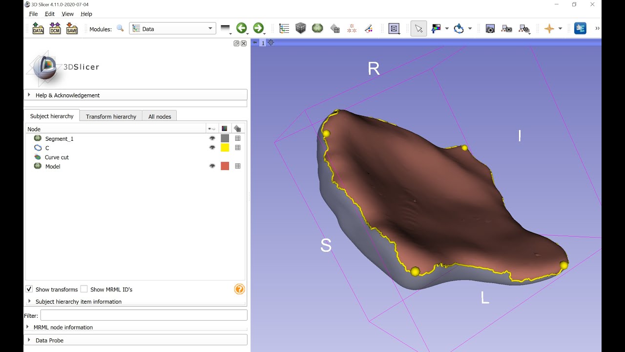Extract one side of a closed surface mesh