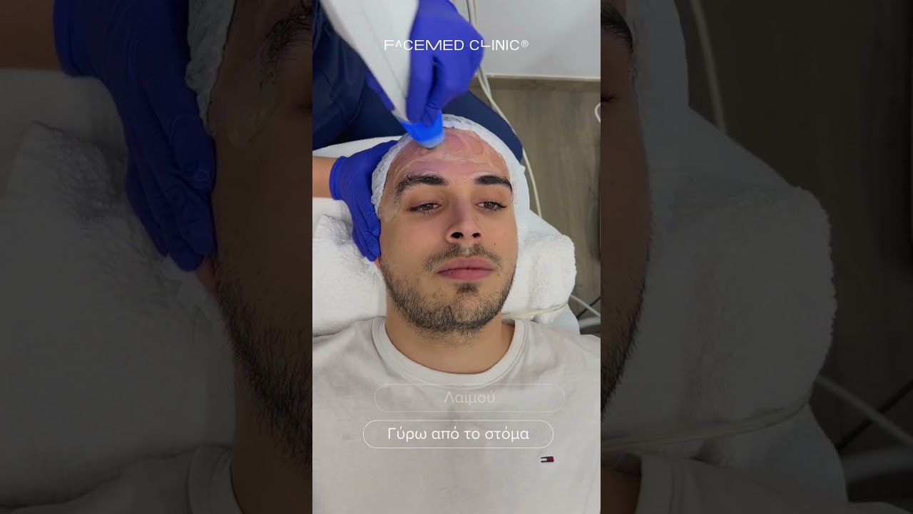 Exilis Elite &Pi;&rho;&omicron;&sigma;ώ&pi;&omicron;&upsilon;