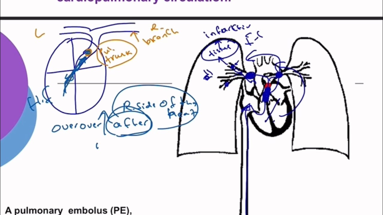 Pathology of Hemodynamic lec3