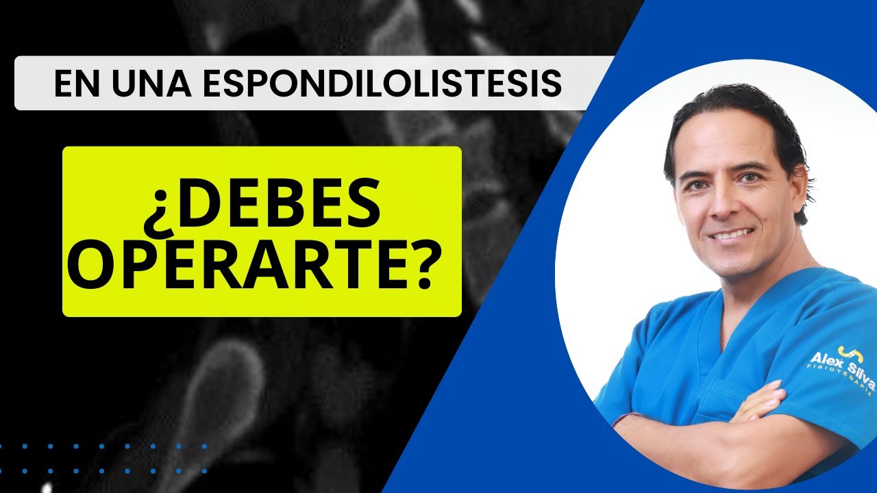 ESPONDILOLISTESIS &iquest;DEBES OPERARTE?