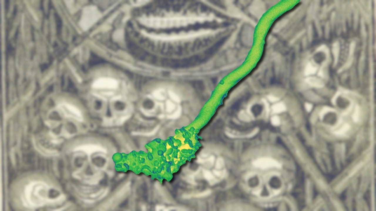 The Mystery of the Missing Medieval Plague