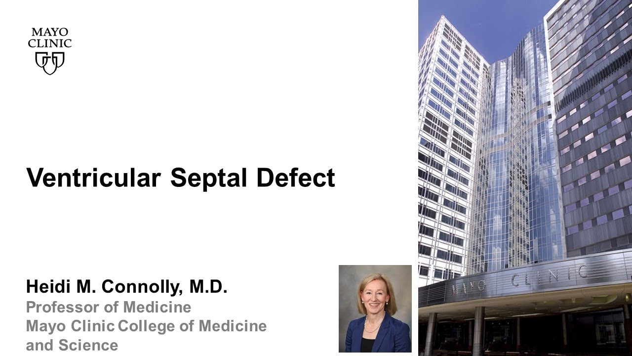 Ventricular Septal Defect