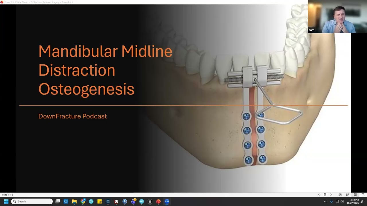 Mandibular Symphyseal Distraction Osteogenesis with Dr. Reza Movahed