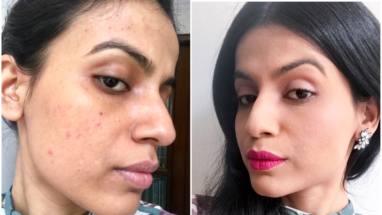 EASY MAKEUP TUTORIAL FOR COVERING ACNE | DARK SPOTS | PIGMENTATION | Medium/Olive Skin