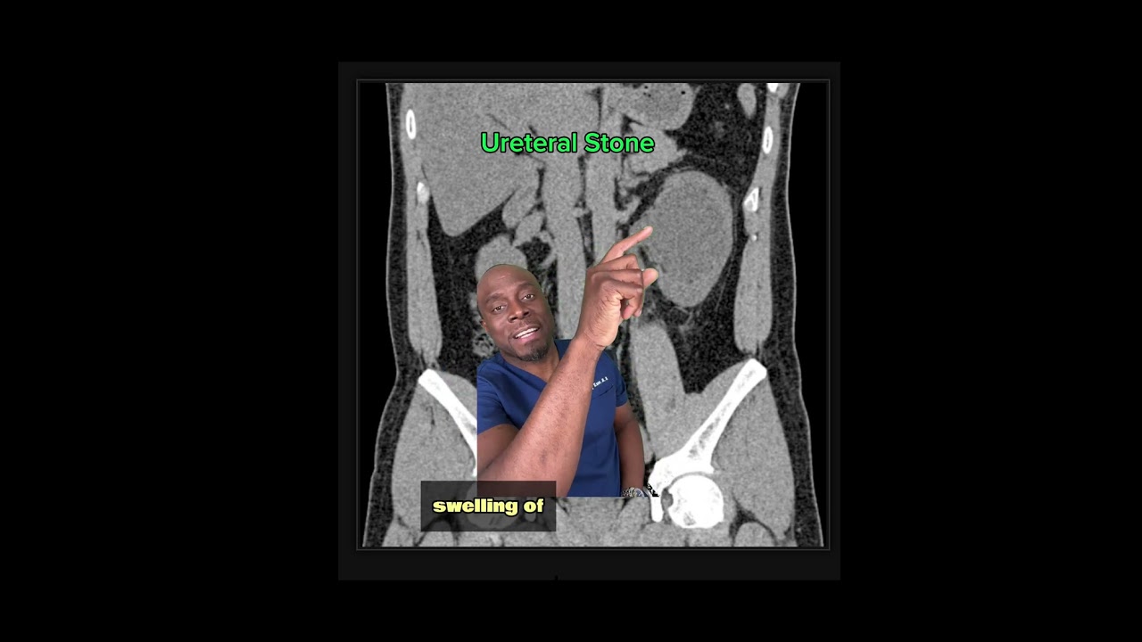 Case #1: Flank Pain