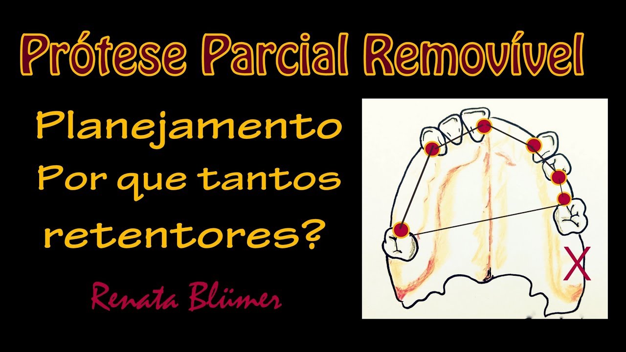 POR QUE TANTOS APOIOS?
