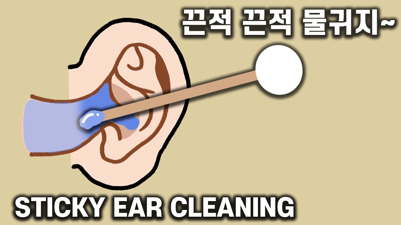 ASMR 초리얼~ 고막에 붙은 물귀지 파내기!!! 귀청소 (노토킹)