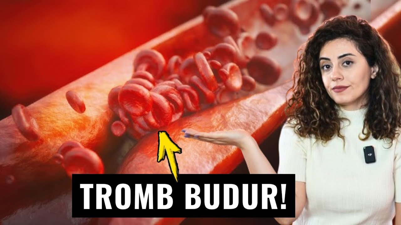 Damarlarda TROMBU Əridən Qidalar Bunlardır - Qanı Laxtalanmağa Qoymur!