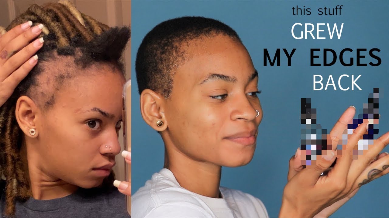 MIRACLE PRODUCT THAT GREW MY EDGES BACK!!!!