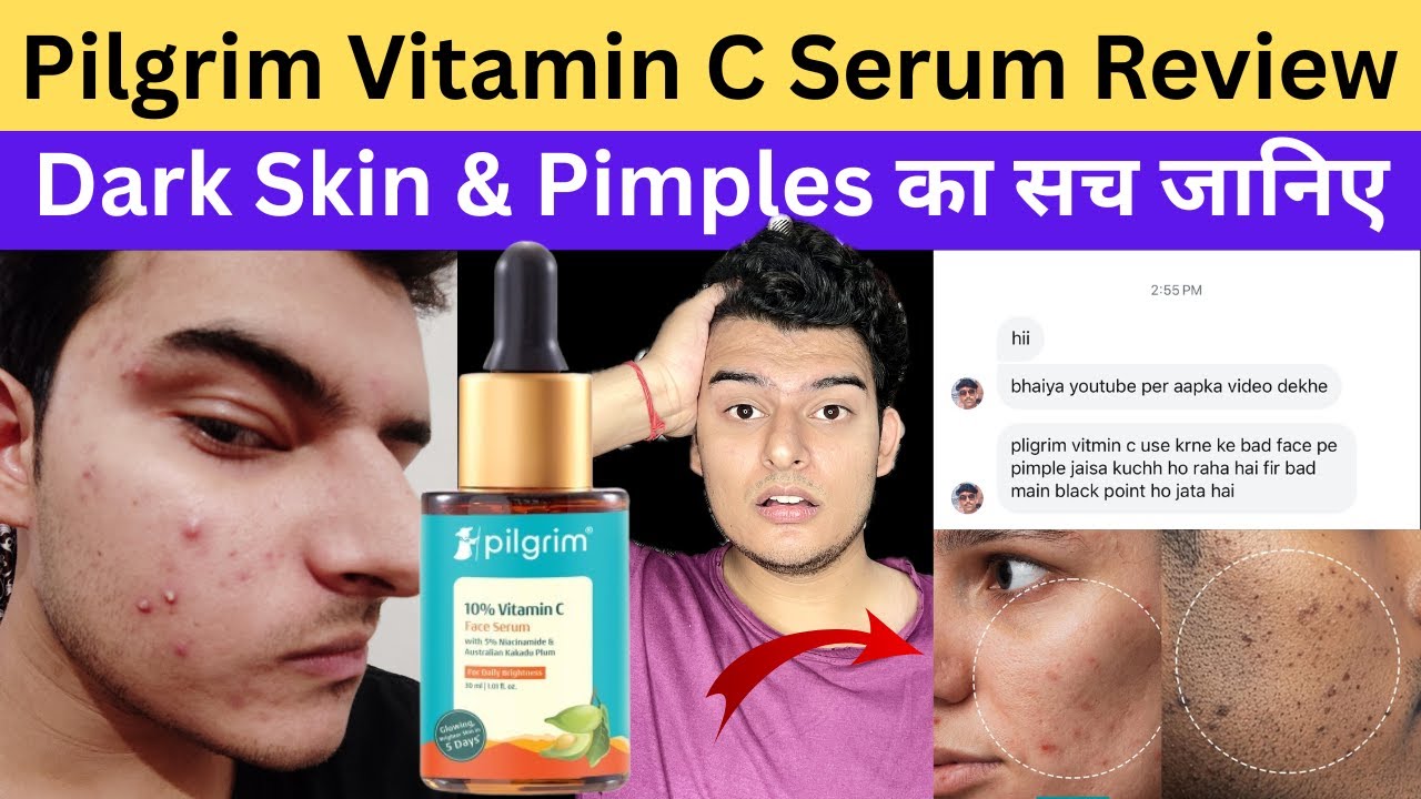 Pilgrim Vitamin C Serum Review | Dark Skin & Pimples का सच जानिए Pilgrim Vitamin c Serum