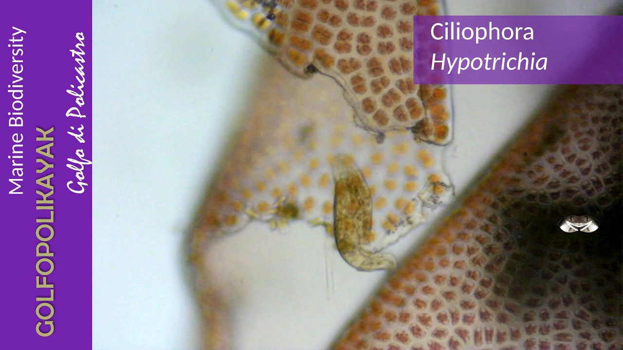 Ciliophora, Hypotrichia
