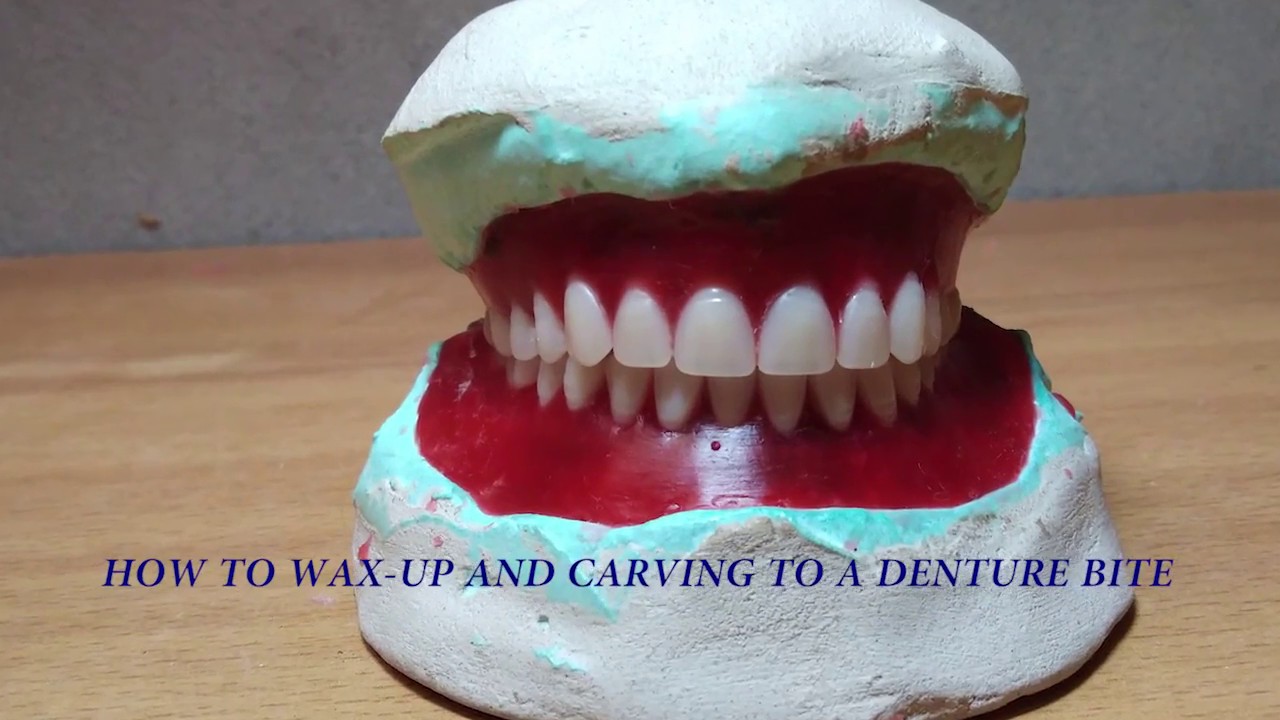 Denture Carving