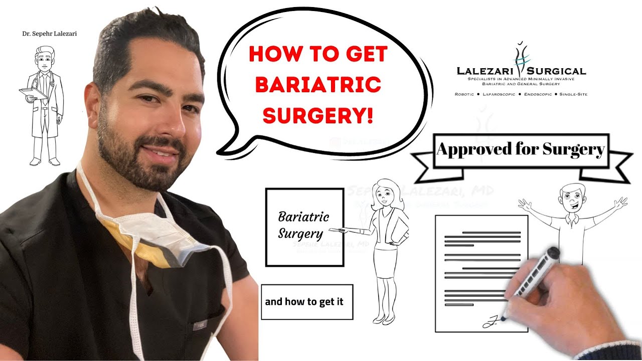 Bariatric surgery: Step by step guide on how to get Weight Loss Surgery
