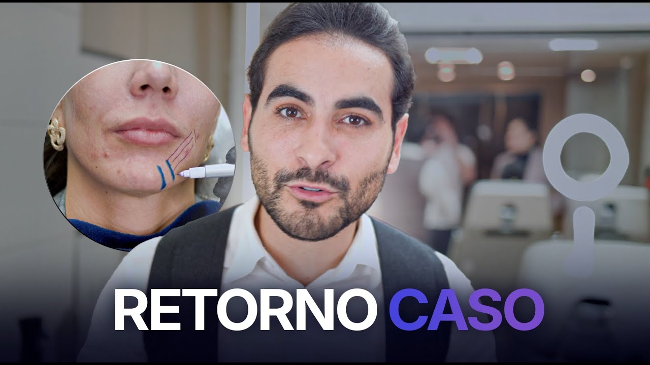 Retorno: Caso clinico com refinamentos.