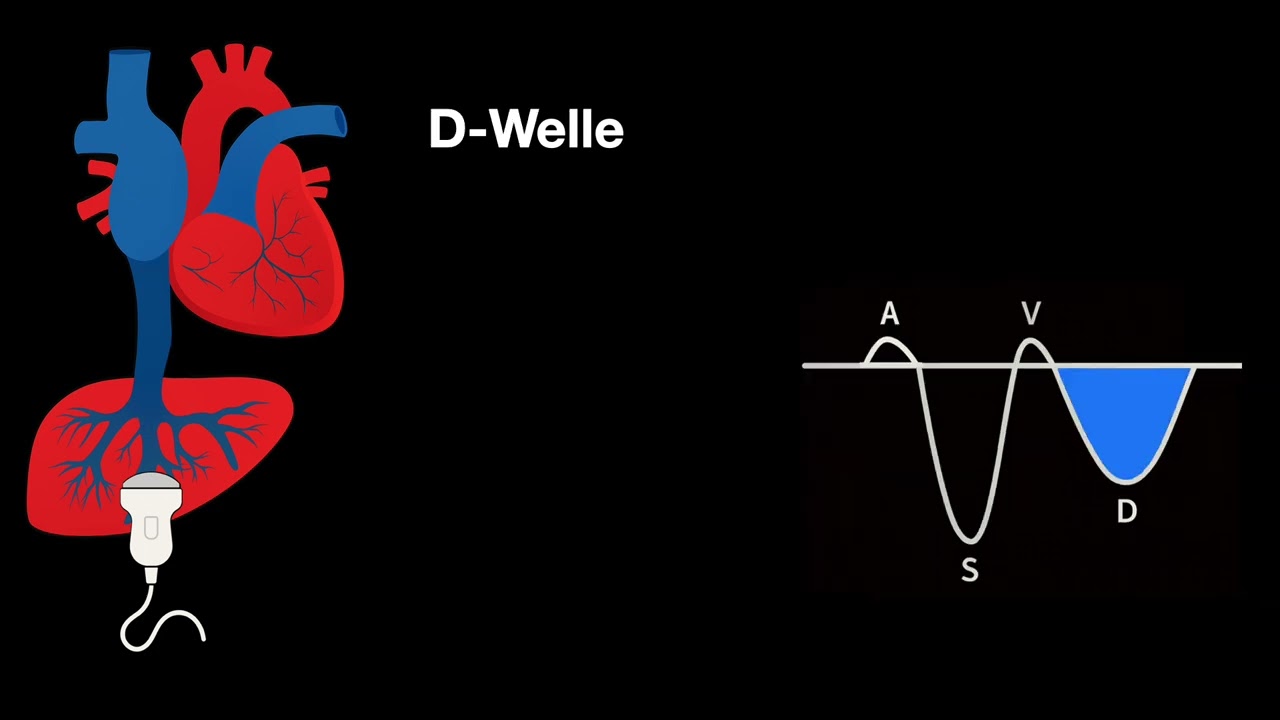 Checkpoints 10-13 - VExUS - Multiorgan-Doppler der Organstauung