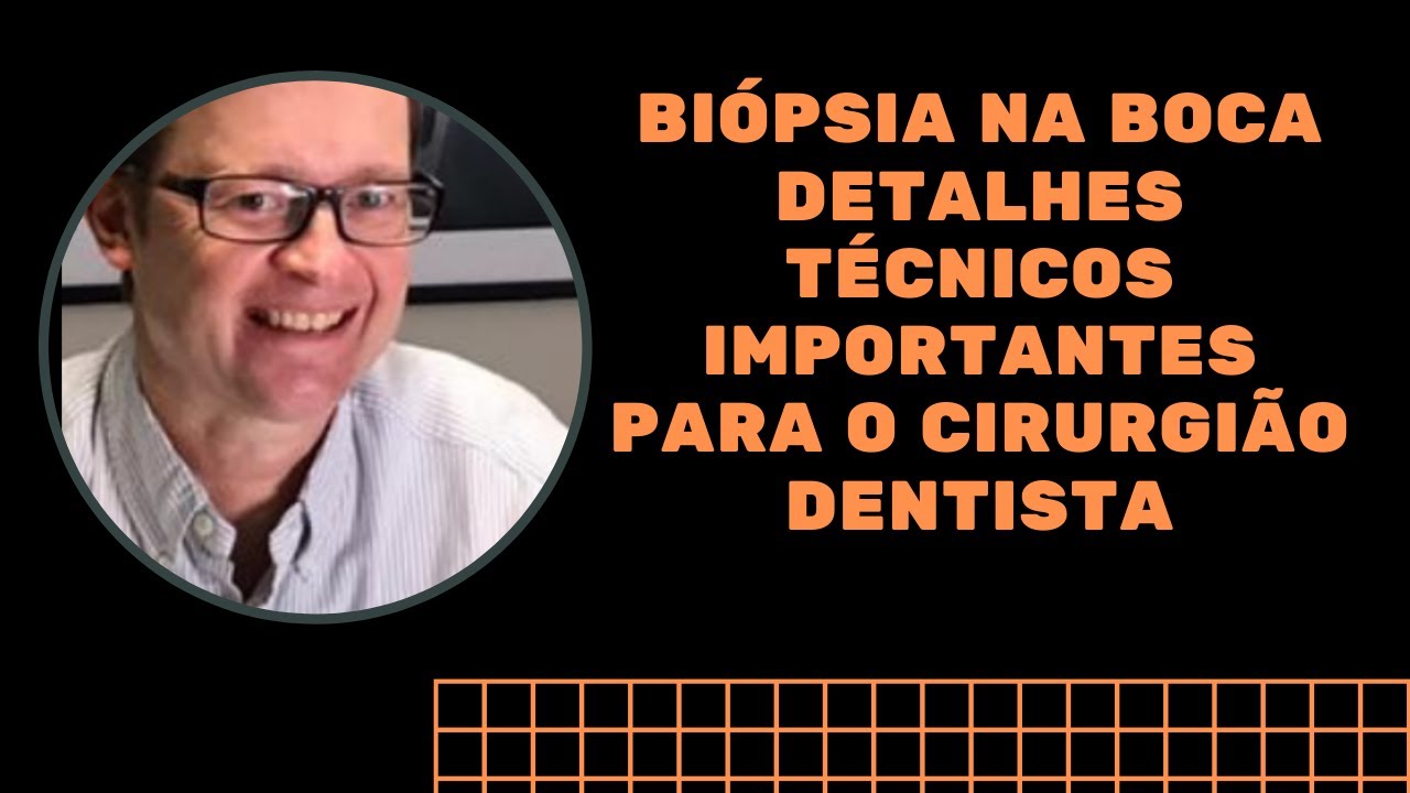 Biópsia na boca. Detalhes técnicos importantes para o cirurgião dentista | Prof Mauricio Volkweis