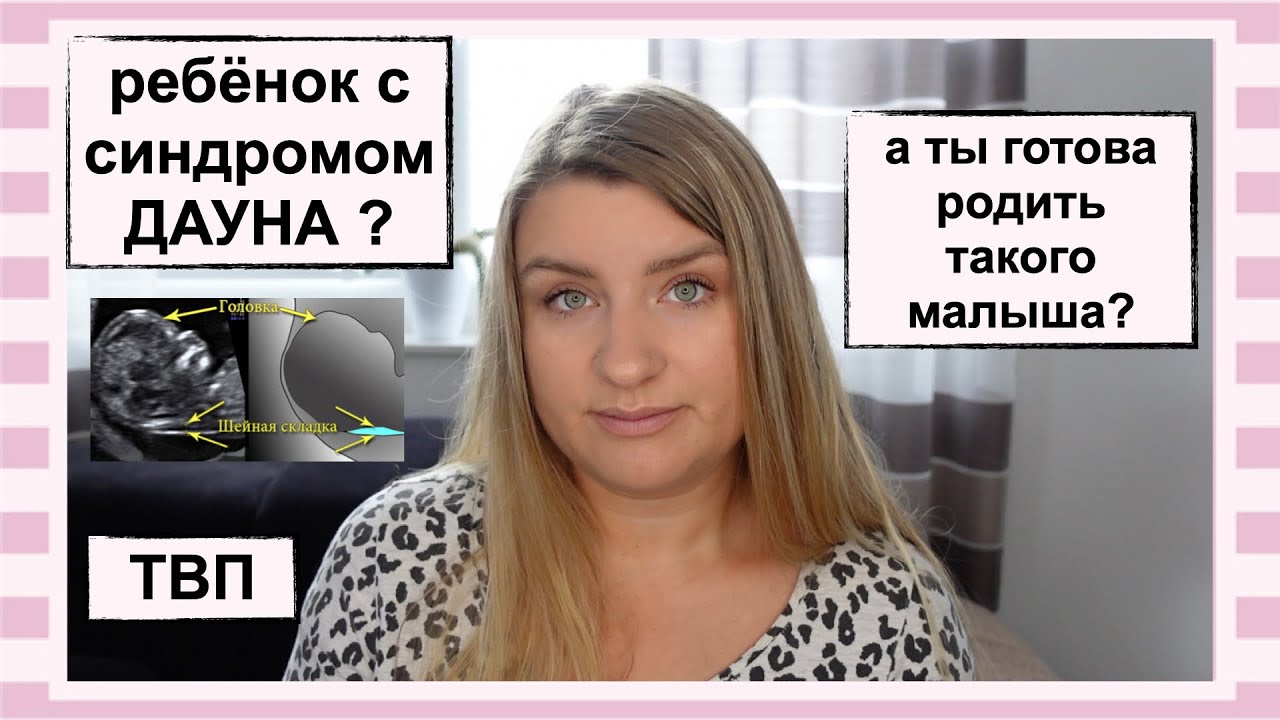 ТОЛЩИНА ВОРОТНИКОВОГО ПРОСТРАНСТВА// МОИ СТРАХИ ПО ПОВОДУ РОЖДЕНИЯ РЕБЁНКА С СИНДРОМОМ ДАУНА
