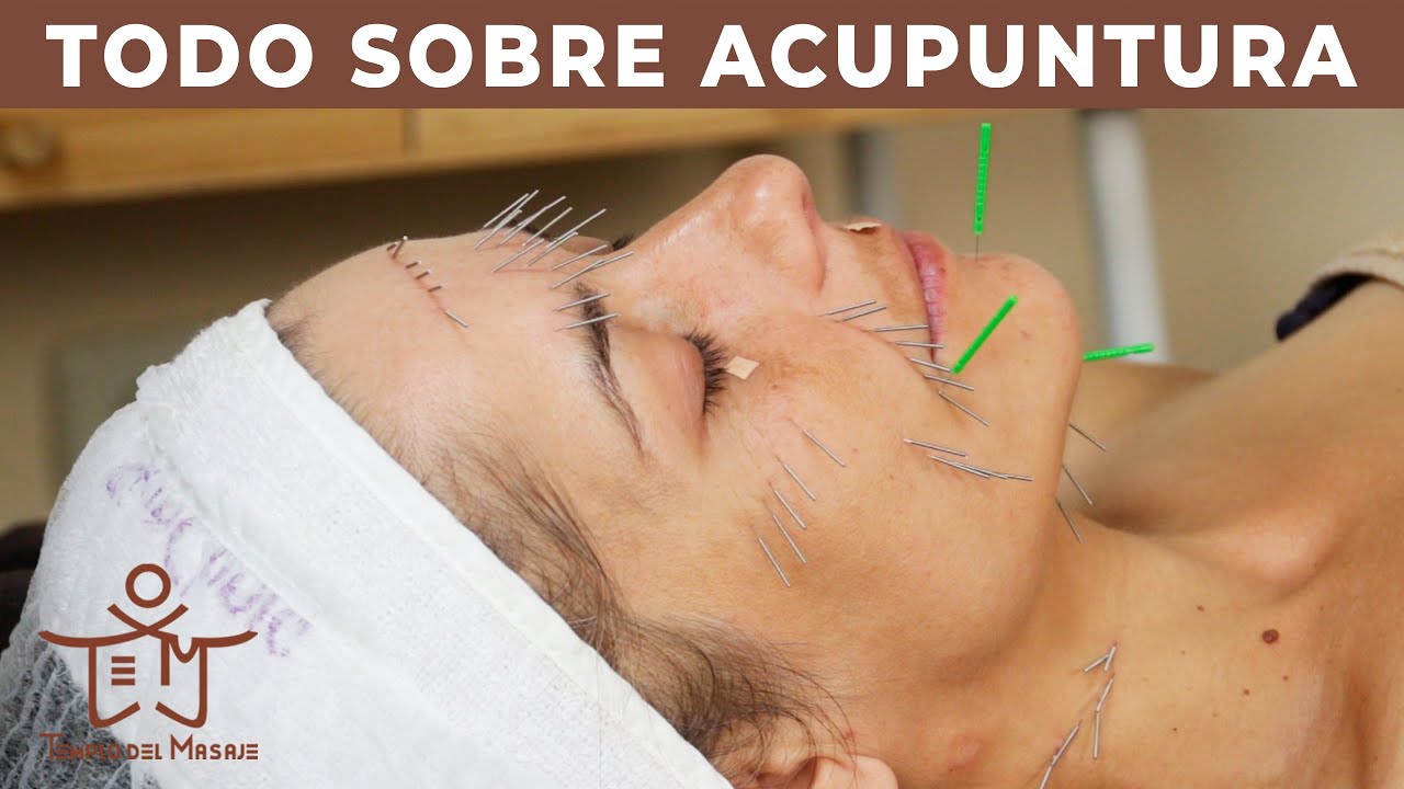 ACUPUNTURA | ¿QUÉ es la ACUPUNTURA? ¿CÓMO funciona? ¿PARA qué SIRVE?