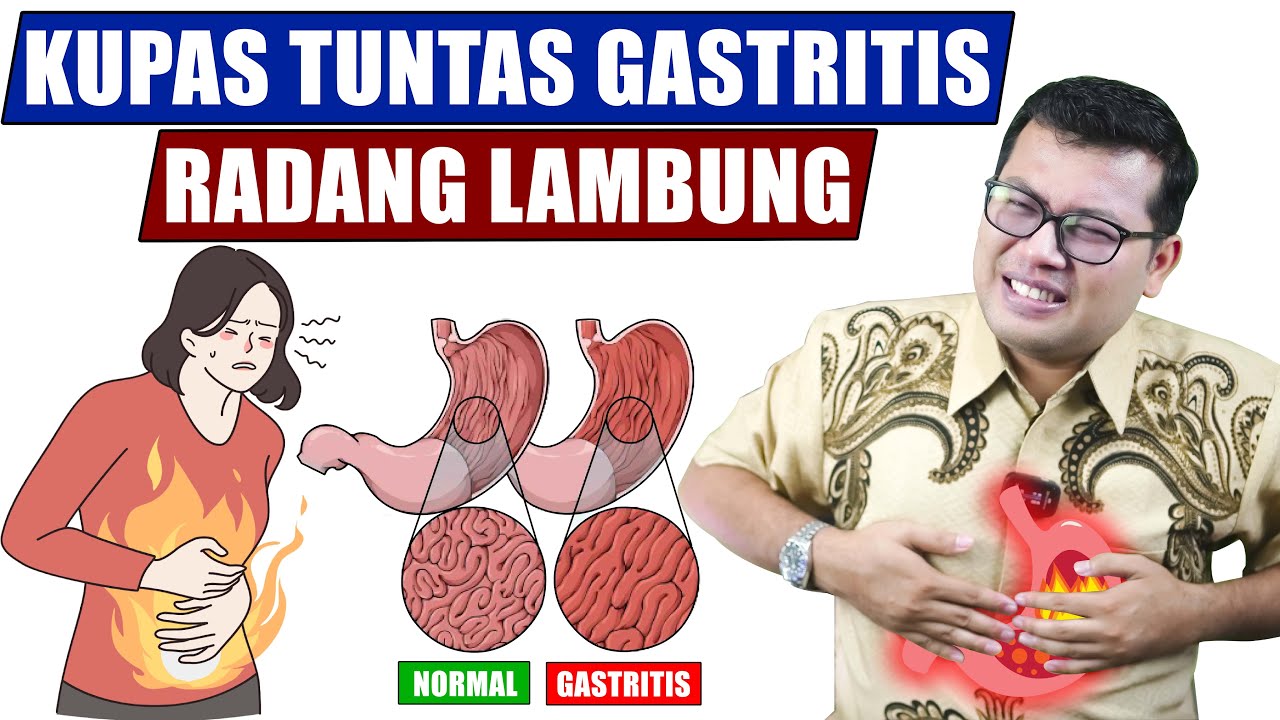 LENGKAP SEPUTAR GASTRITIS ATAU RADANG LAMBUNG - DOKTER SADDAM ISMAIL