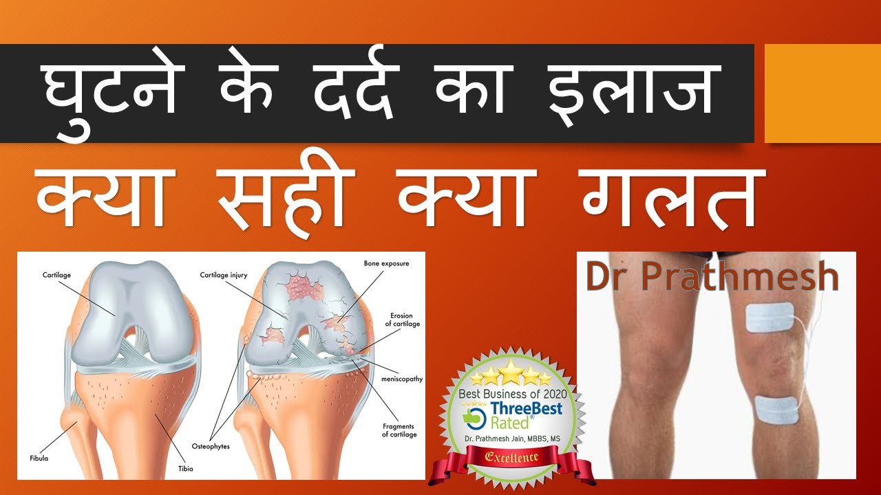 घुटने के दर्द का इलाज Knee Pain Treatment Hindi (Knee Arthritis Treatment)घुटने के घिसारे का इलाज