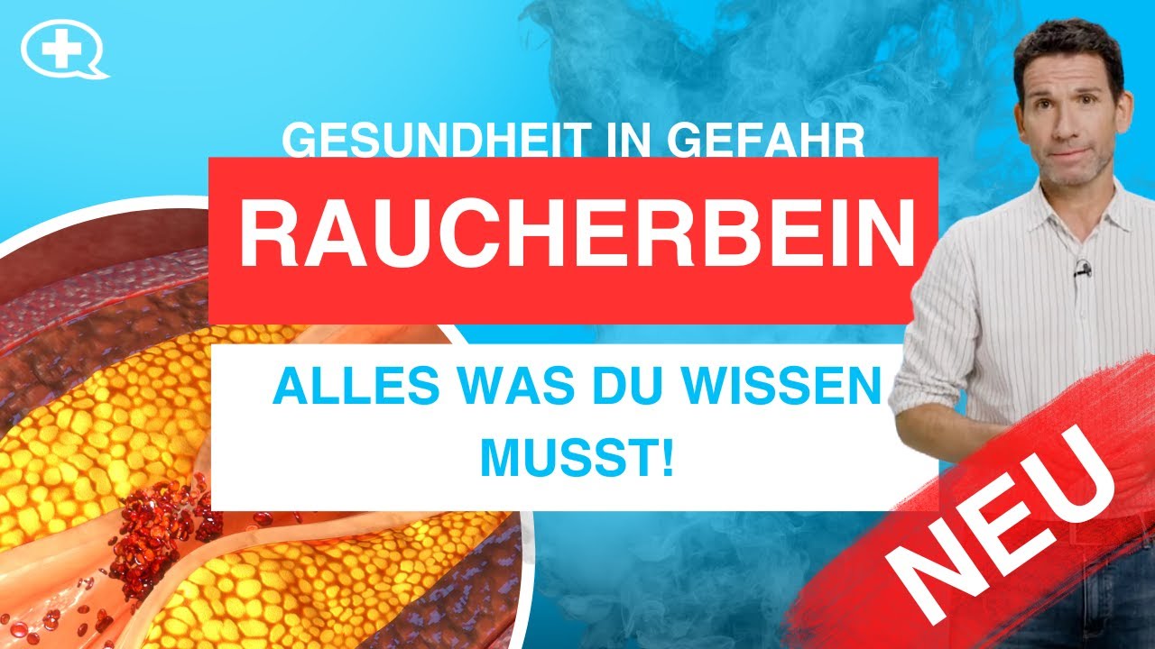 Raucherbein: Was ist das? Und warum können auch Nichtraucher erkranken?