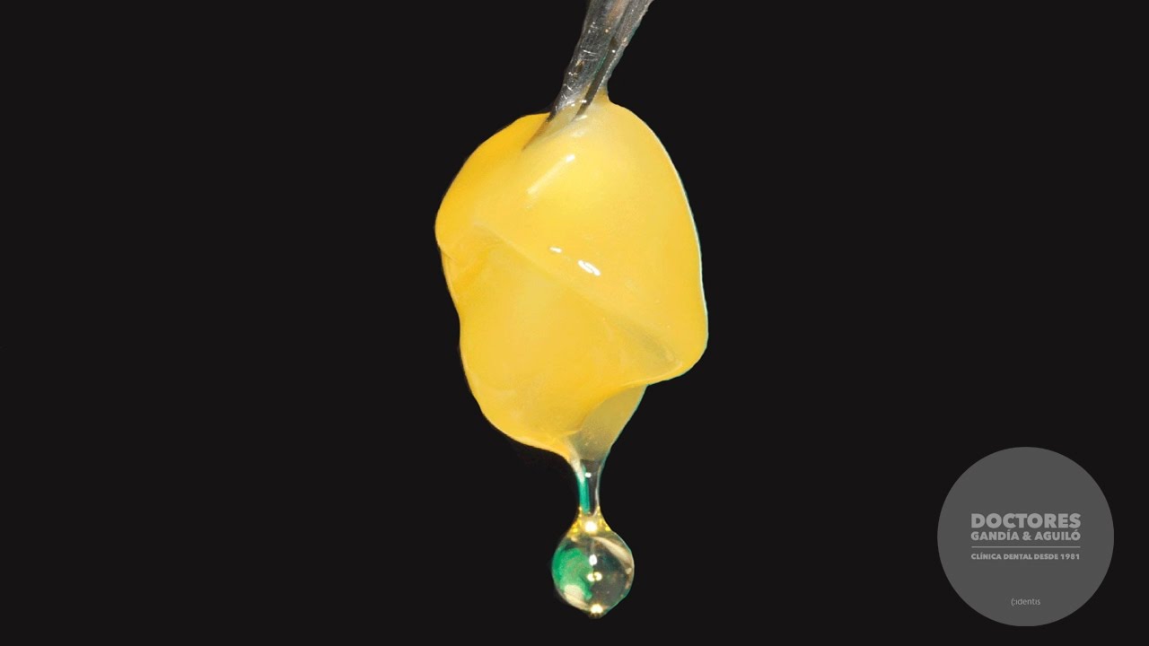 Platelet Rich Plasma regeneration .... Regeneración dental con plasma rico en plaquetas