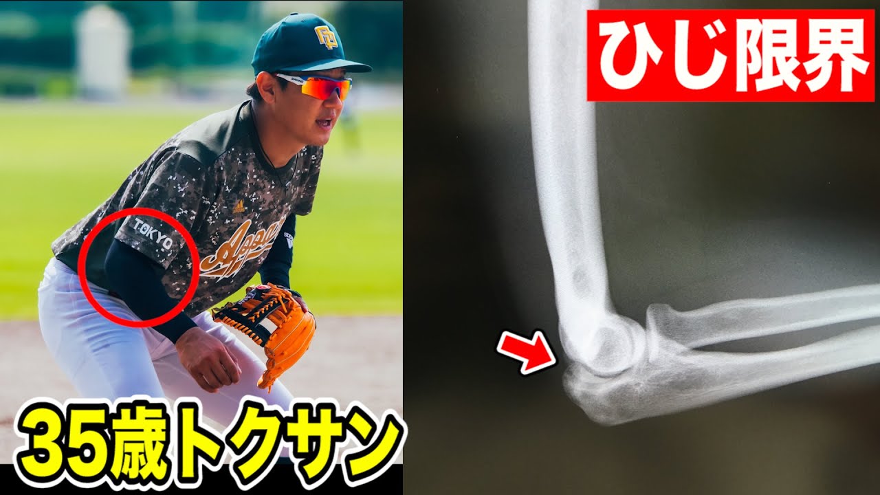 35歳トクサンの肘が限界…野球人生の終わりが近かった。