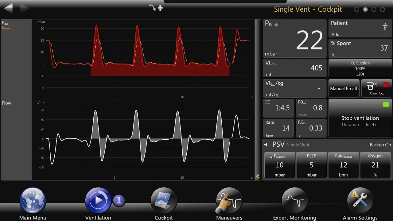 bellavista™ Ventilator: Automatic Tube Compensation