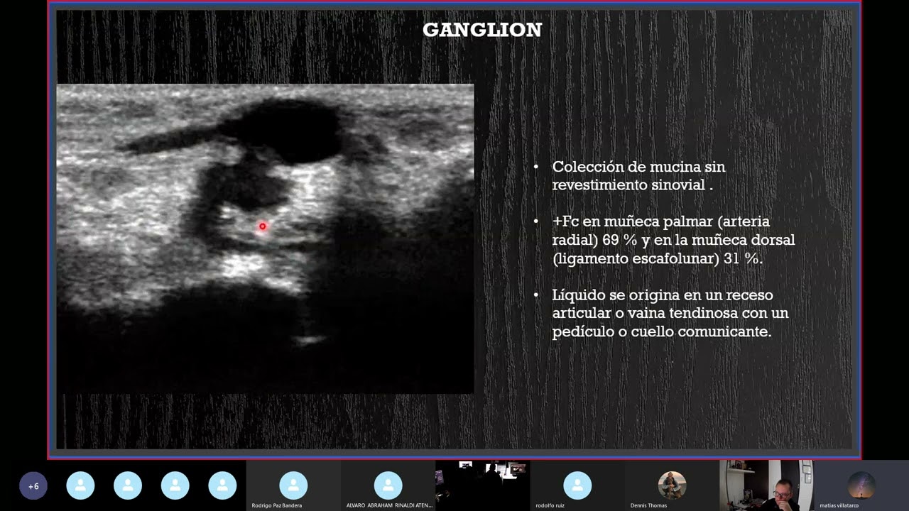 Lesiones Tejidos Blandos  consenso evaluación por Ultrasonidos