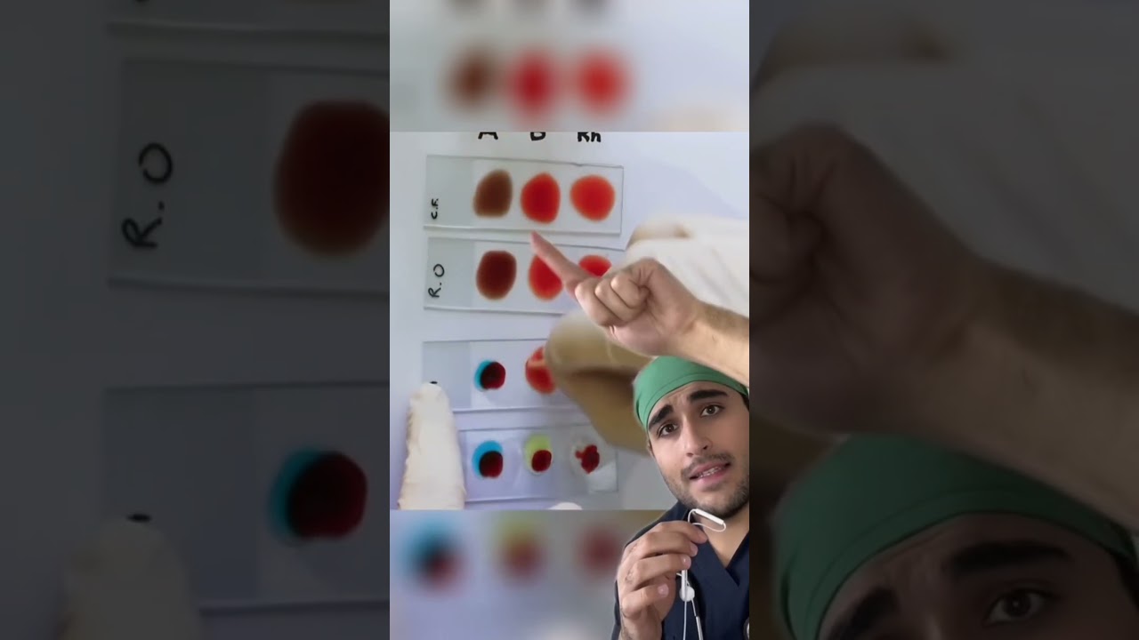 Doctor explains: How to know your blood type?!🤯🤯