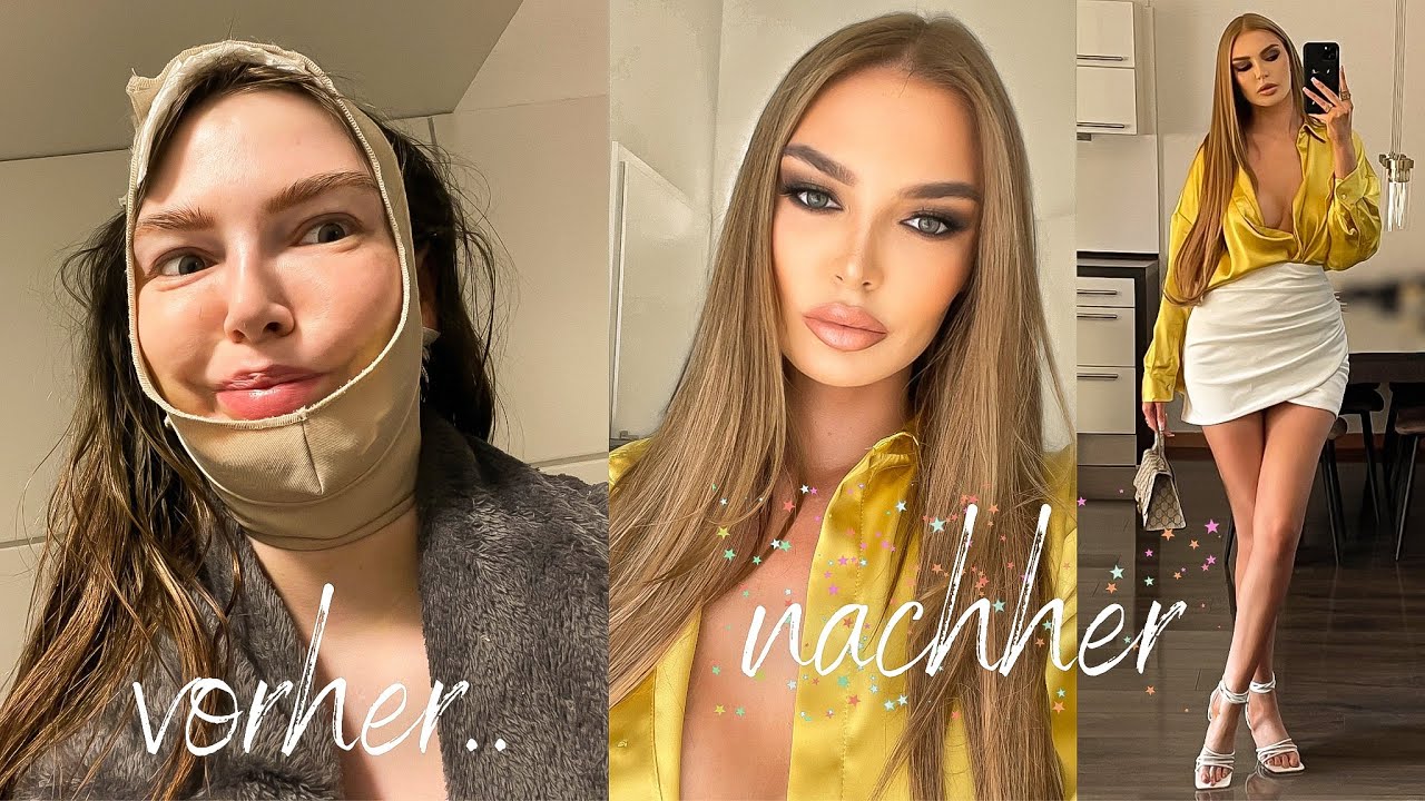 Full Glow Up nach Op Transformation  - Haare, Lippen, Aquafacial, Nägel & Outfit