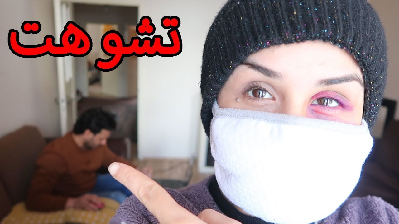 ضربني زوجي وشوه وجهي بسبب؟