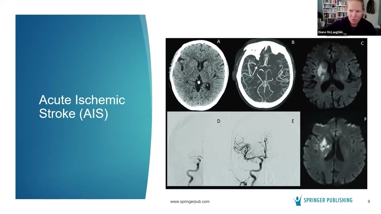 Updates in Stroke Care 2023