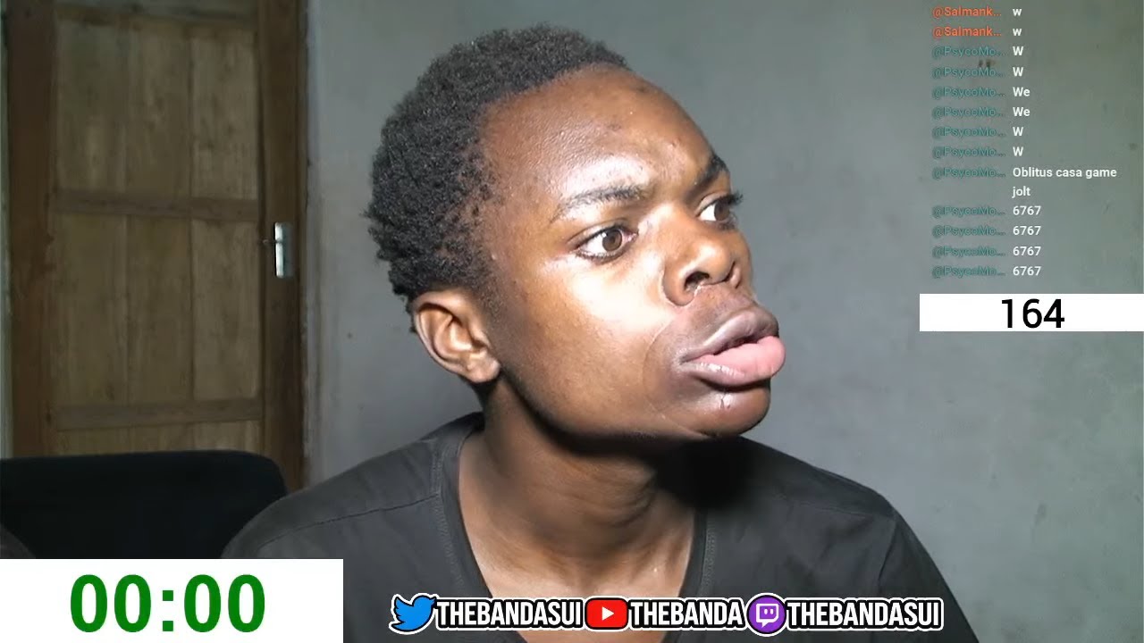 trying Kylie Jenner Lip Challenge 😭