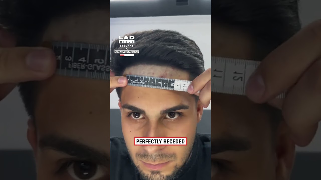 Sharpening My Hairline with Prosthetic Hair Cap