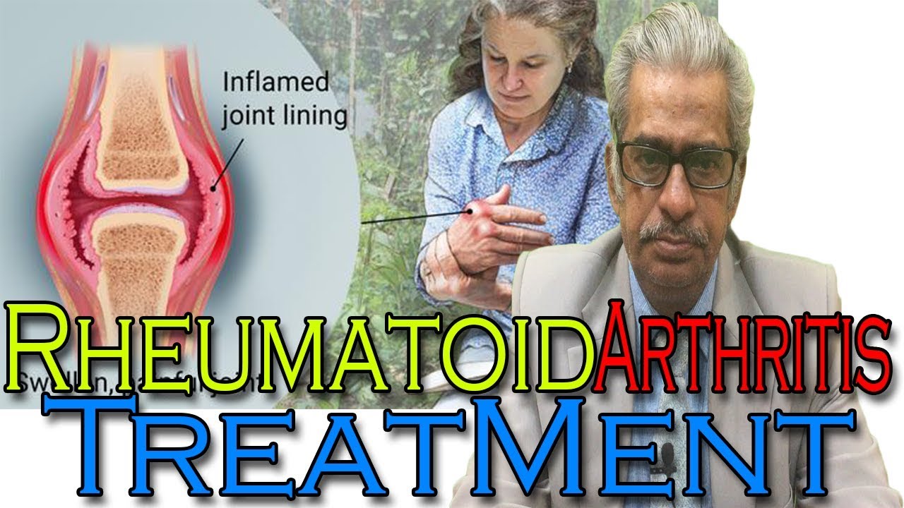Rheumatoid Arthritis in Hindi - Discussion and Treatment in Homeopathy by Dr P.S. Tiwari