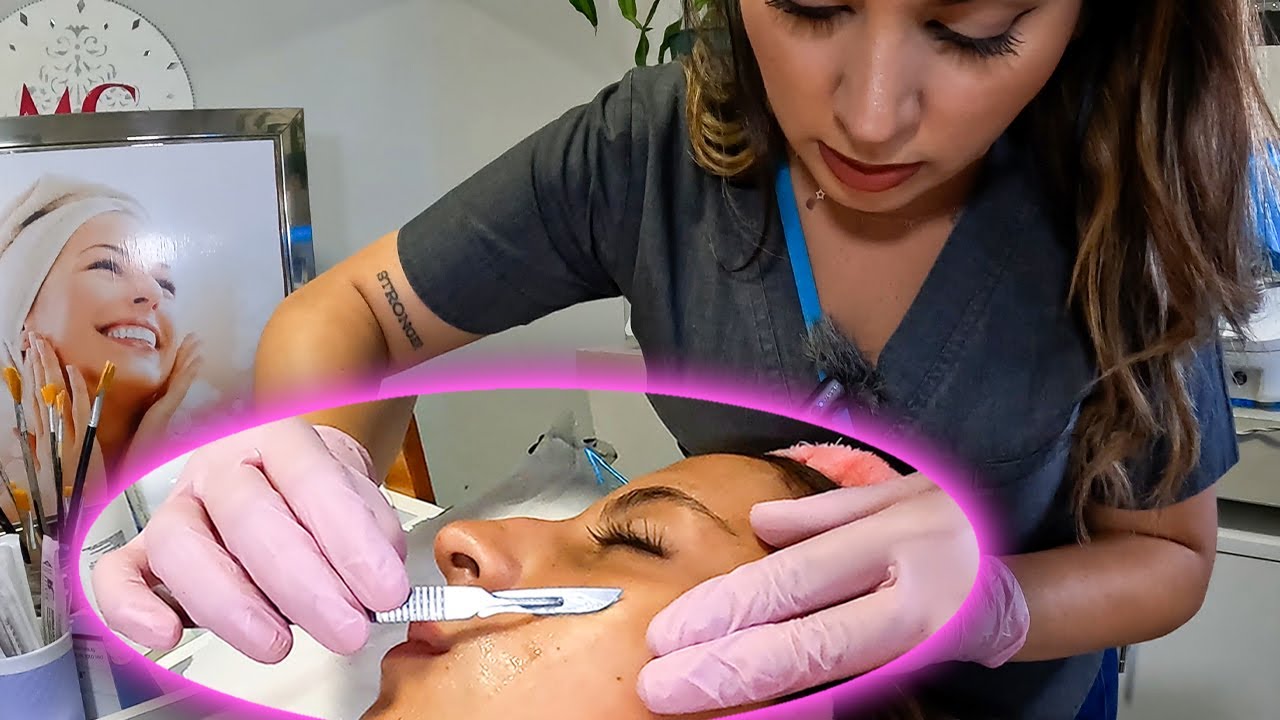 DERMAPLANING ✅ Te Explicamos TODO 🔥 SESIÓN PASO a PASO y  RESULTADOS INMEDIATOS 😊
