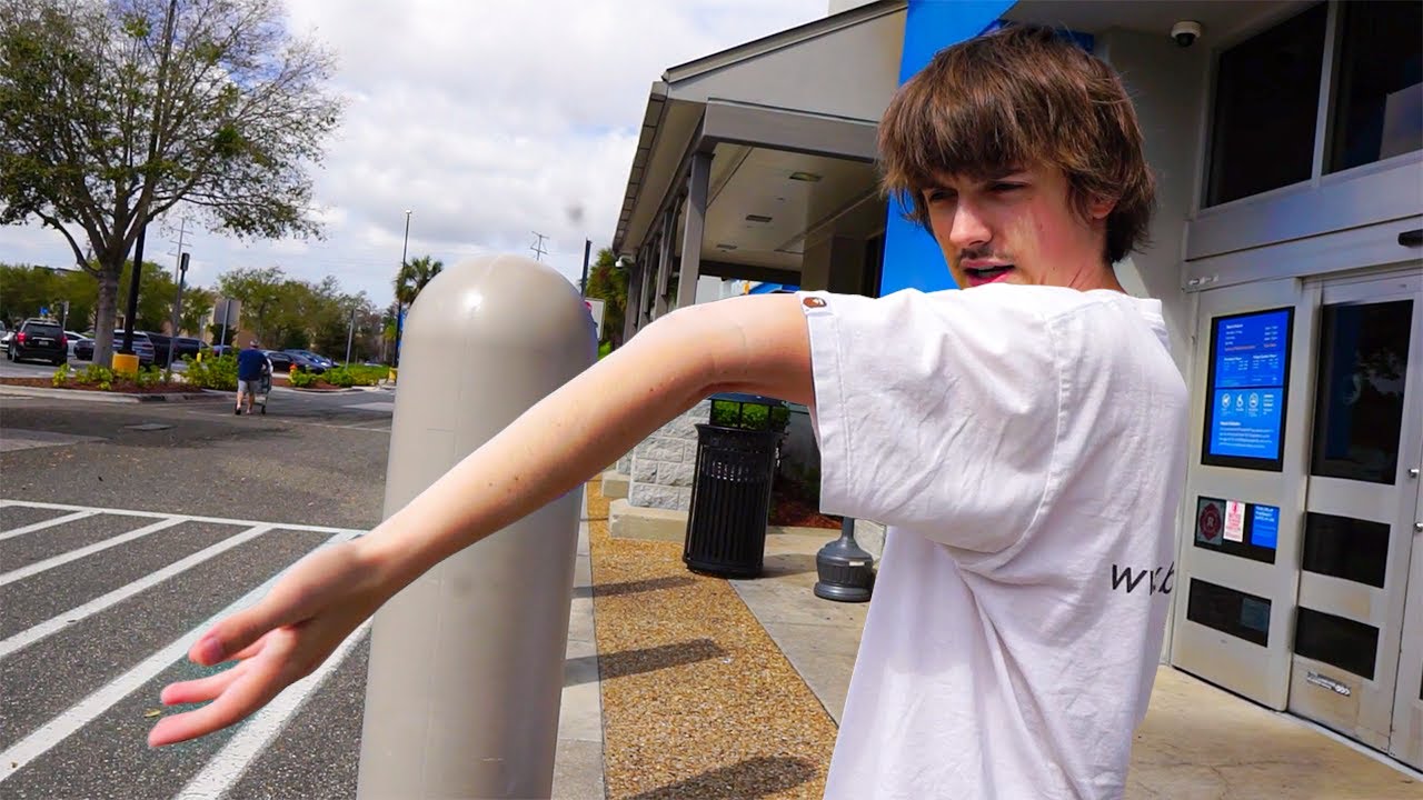 я сломал руку